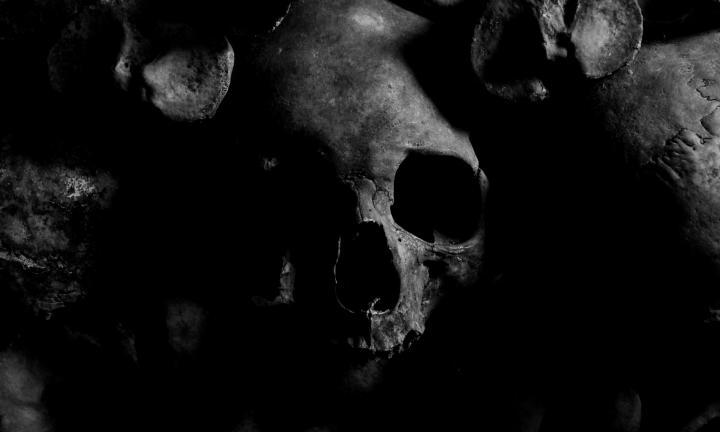 Bones