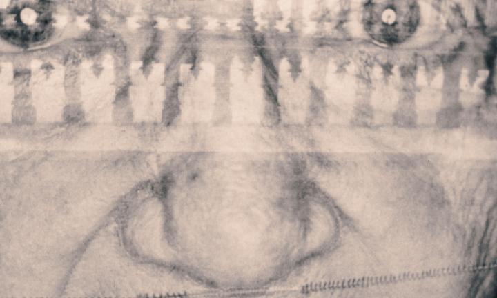 close up black and white picture of elderly face with a stitch under the nose across the width of the picture